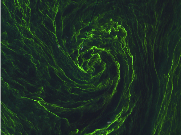 Il vortice di alghe fotografato dal satellite europeo Sentinel 2A.  In alto è riconoscibile una nave, la cui scia appare come una riga nera (fonte: Copernicus Sentinel data 2015/ESA)
