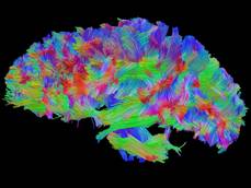Stress cronico riduce neuroni cervello
